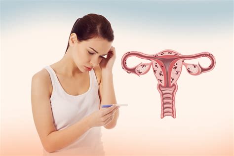 Qual é A Relação Entre Endometriose E Fertilidade Clínica Vilara