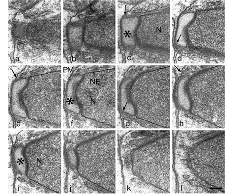 Electron Micrographs Of Ultrathin Sections Through A Spermatid Of