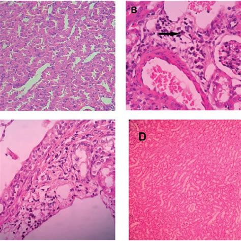 Effect Of Chrysin Treatment On The Liver Histological Changes Which