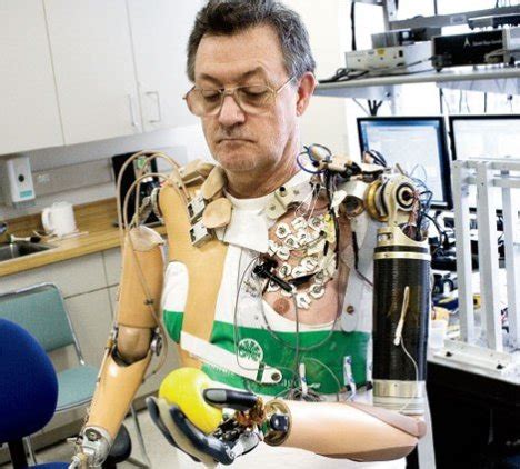 Bionic arm coming in 2009 | Ubergizmo