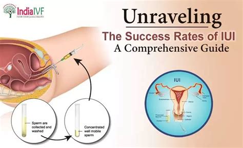 Is IUI 100 Successful Unmasking The Realities Of IUI Success Rates