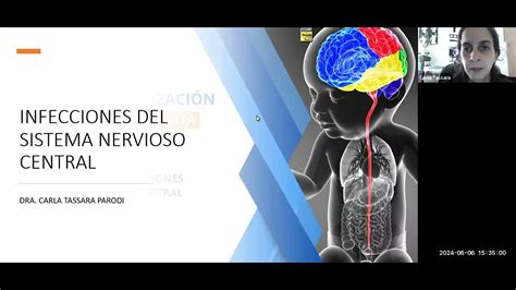 TEMA 70 INFECCIONES DEL SNC EN PEDIATRIA YouTube