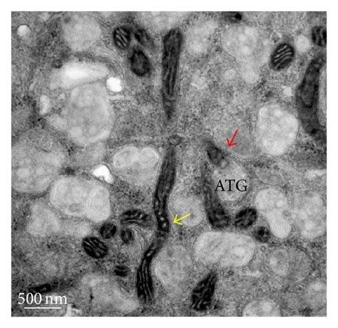 Transmission Electron Tem Analysis Of Mitochondrial Remodeling Inmscs