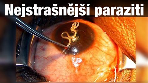 top  nejstrasnejsi paraziti youtube