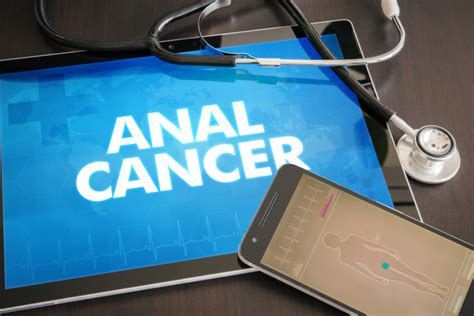 Anal Cancer Fighting The Stigma UT Health San Antonio