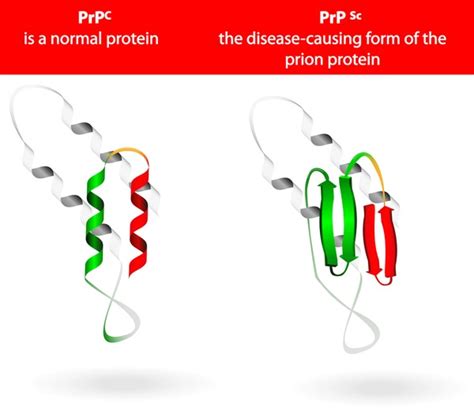 27 Creutzfeldt Jakob Disease Cjd Royalty Free Photos And Stock Images