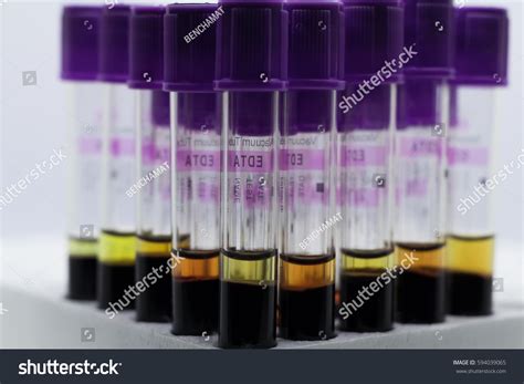 Analysischemistry Images, Stock Photos & Vectors | Shutterstock