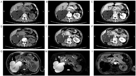 Imaging examination of the abdomen. CT images of the abdomen presented... | Download Scientific ...