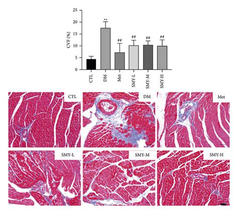 SMY Alleviated Cardiomyocyte Apoptosis And Myocardial Fibrosis In Model