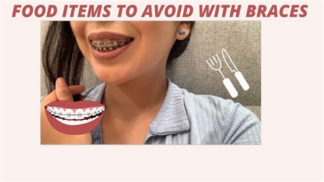 Braces Update What I Can And Cannot Eat Rubber Bands Youtube