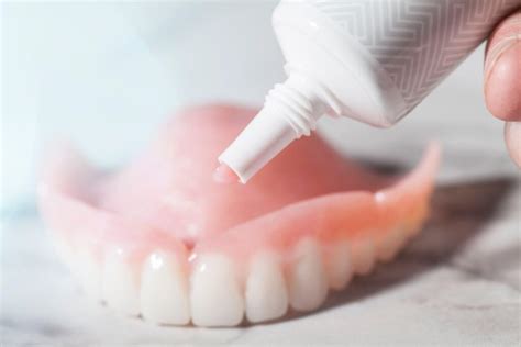 How To Remove Denture Glue From Your Gums At Karl Burns Blog