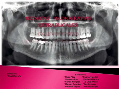 Tecnicas Radiograficas Extrabucales Diapositivas Gabriela Zapata Ppt