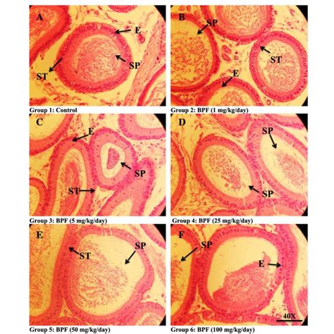 Photomicrographs Of Rats Testicular Tissues Of Control And Treated