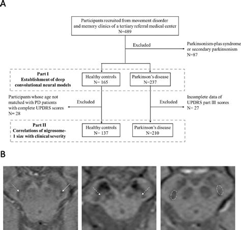 Substantia Nigra Nigrosome 1 Imaging Correlates With The Severity Of Motor Symptoms In Parkinson