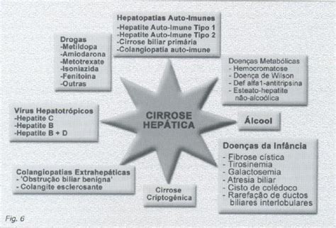 Cirrose Hepática Causas de Cirrose