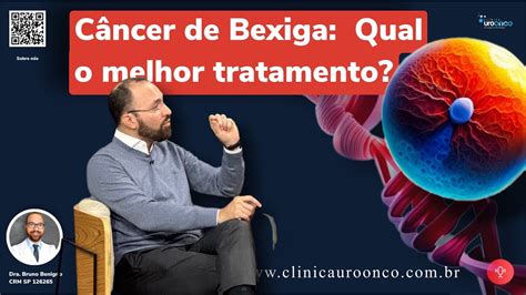 Preserva O Raspagem Radioterapia Ou Retirar Qual O Melhor