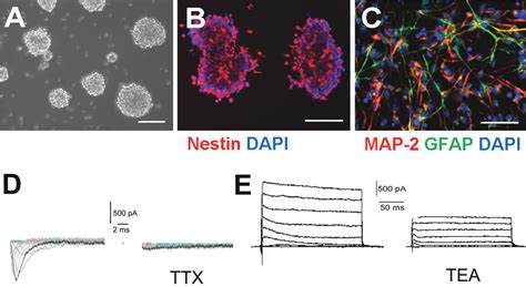 Figure 1 from Inhibition of the Rho signaling pathway improves neurite ... 