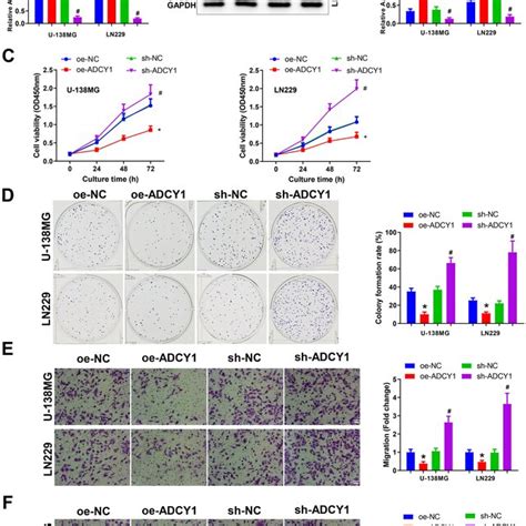 Overexpressing Adcy1 Represses Glioma Cell Proliferation Migration