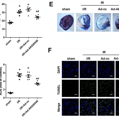 Lncrna Ak Inhibited I R Injury Induced Oxidative Stress And