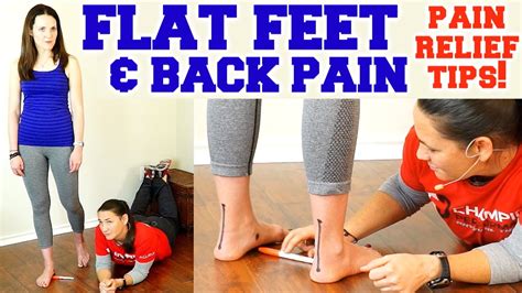 How To Fix Flat Back A Comprehensive Guide To Correcting Lumbar