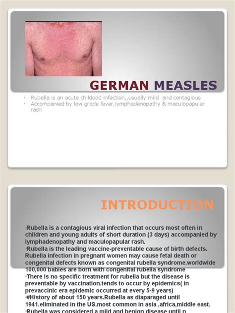 German Measles | PDF | Measles | Infection