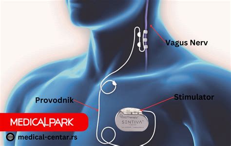 Epilepsija Kod Dece I Le Enje Vns Metodom Eklinika