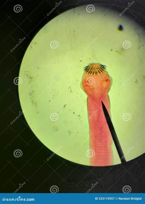 Microscopic View of Tapeworm Stock Image - Image of glass, medical ...