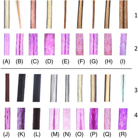 Histopathology Of Aging Of The Hair Follicle FernandezFlores 2019