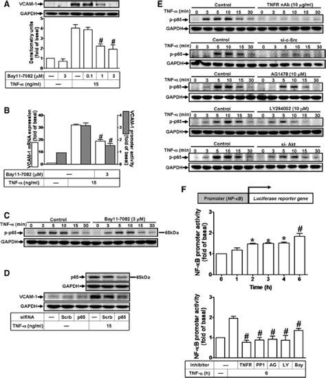 Tumor Necrosis Factor Alpha Induces VCAM 1 Mediated Inflammation Via C