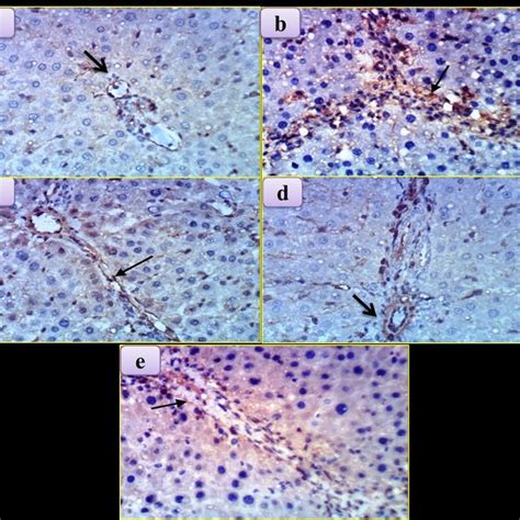 Photomicrographs Of Immunohistochemical Staining Of α Smooth Muscle