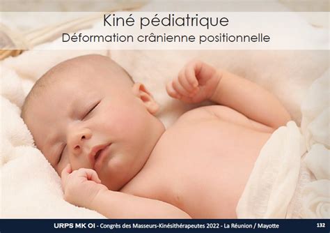 Kiné pédiatrique déformation crânienne positionnelle URPS MK OI