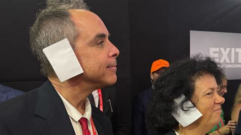 Rnc Attendees Sport Ear Bandages In Solidarity With Trump