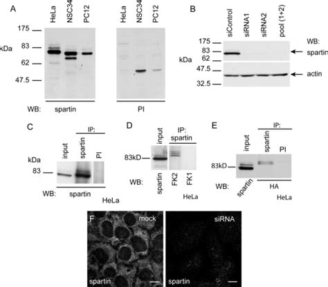 A Western Blot Wb Of Hela Nsc34 And Pc12 Lysates Using α Spartin Download Scientific