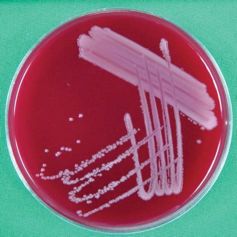 Sheep Blood Agar Plate Showing Mm Sized Raised Grayish White