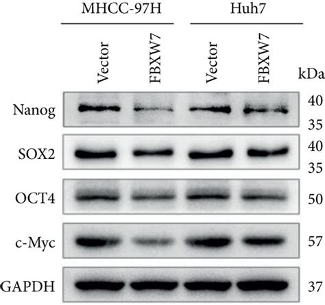 Fbxw Overexpression Inhibits The Stem Cell Like Properties Of Hcc