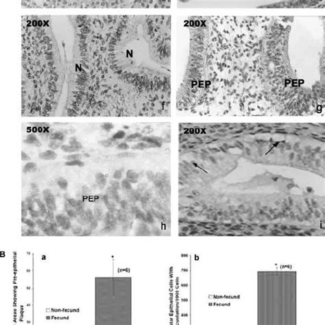 A Histomorphological Analysis Of Peri Implantation Phase Endometria