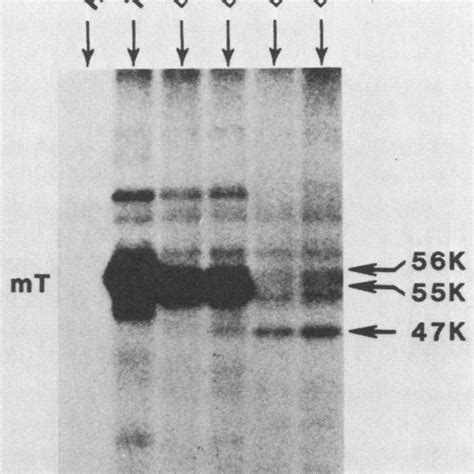 Autoradiograph Of A Sds Polyacrylamide Gel Showing The Location