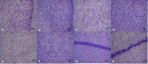 Histological sections of the cerebral cortex and hippocampal areas of ... 