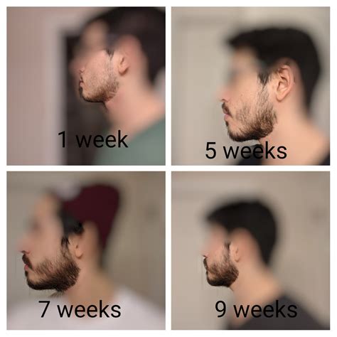 6 Quick Ways To Grow A Fuller Beard Artofit