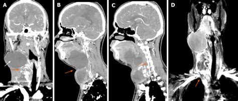 Computed Tomography And Magnetic Resonance Imaging A Computed Download Scientific Diagram