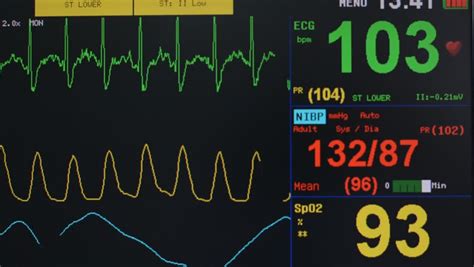 Heart Blood Pressure Monitor Used In A Hospital Room Stock Footage ...