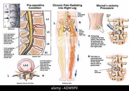 Lumbar Spine L L