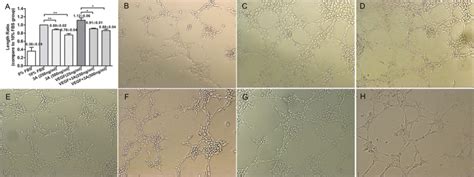 Effects Of Semaphorin A On Human Umbilical Vein Endothelial Cell Tube