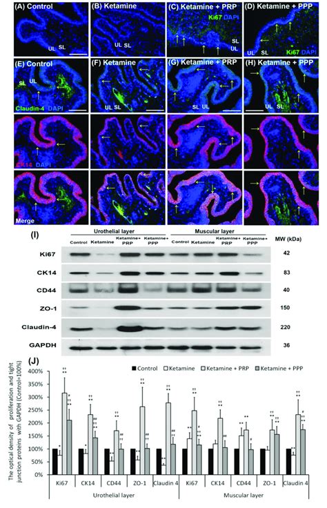 Prp Strengthened Urothelial Proliferation And Junction Associated