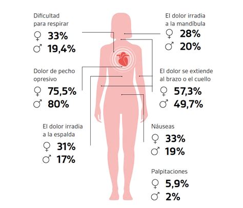 Natura Fósil Asignar Señales De Infarto En Mujeres Punta De Flecha