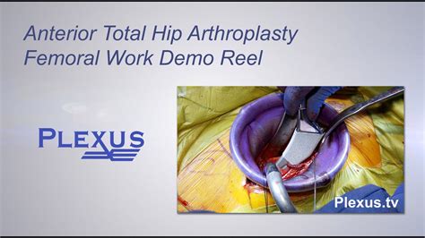 Anterior Total Hip Arthroplasty Femoral Work Surgery Video Youtube