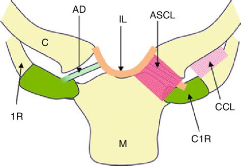 2 Schematic illustration of the anatomy of the sternoclavicular joint ...