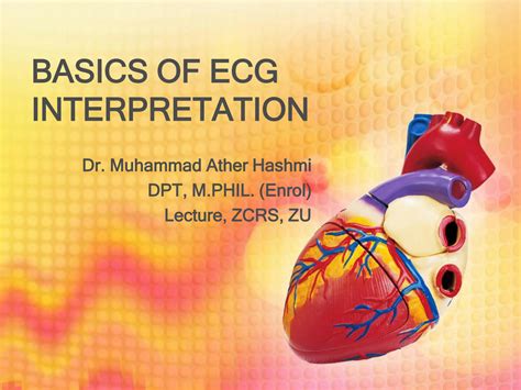 SOLUTION: Basics of ecg interpretation - Studypool