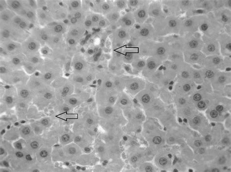 Stasis In The Blood Vessels Of The Rat Liver Hemomicrocirculatory Bed