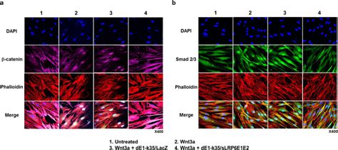 Inhibited nuclear translocation of β catenin and Smad 2 3 by